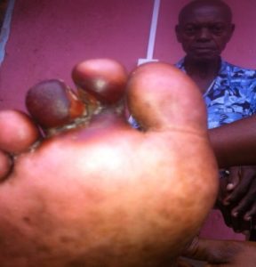 African Neighborhoods & Medical Missions: Alfred's Story